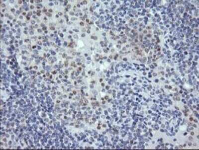 Immunohistochemistry: RNF39 Antibody (OTI5E10) - Azide and BSA Free [NBP2-73927]