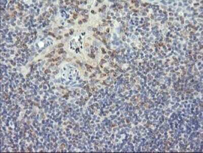Immunohistochemistry: RNF39 Antibody (OTI5E10) - Azide and BSA Free [NBP2-73927]