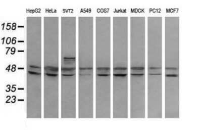 Western Blot: RNF39 Antibody (OTI5E10)Azide and BSA Free [NBP2-73927]