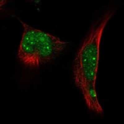 Immunocytochemistry/ Immunofluorescence: RNF4 Antibody [NBP3-17431]