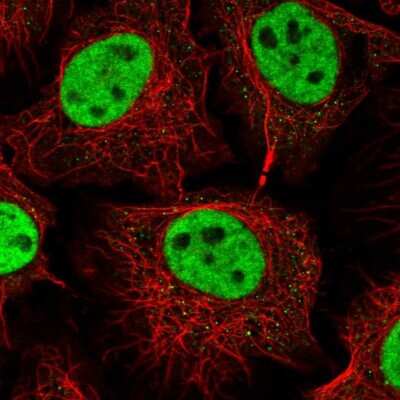 Immunocytochemistry/ Immunofluorescence: RNF40 Antibody [NBP2-54968]