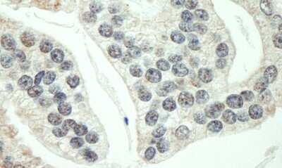 Immunohistochemistry-Paraffin: RNF40 Antibody [NB100-2247]