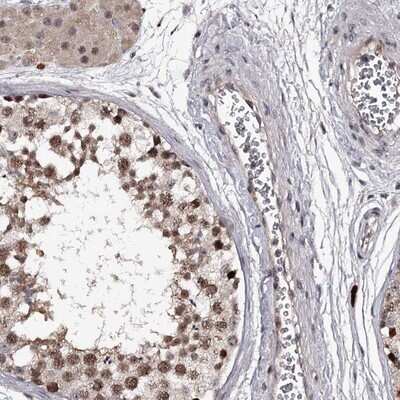 Immunohistochemistry-Paraffin: RNF44 Antibody [NBP1-82930]