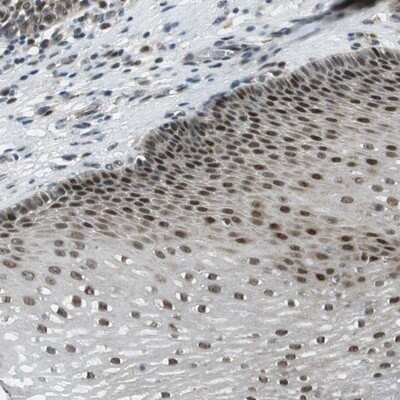 Immunohistochemistry-Paraffin: RNF70 Antibody [NBP1-87399]