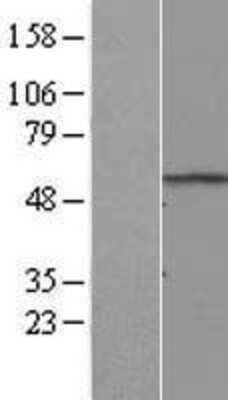 Western Blot: RNF8 Overexpression Lysate [NBL1-15460]