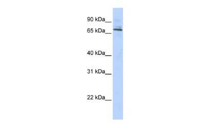 Western Blot: RNF89 Antibody [NBP2-83460]