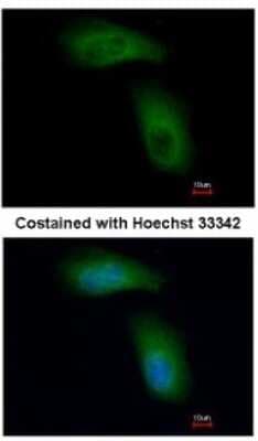 Immunocytochemistry/ Immunofluorescence: RNF98 Antibody [NBP1-33644]