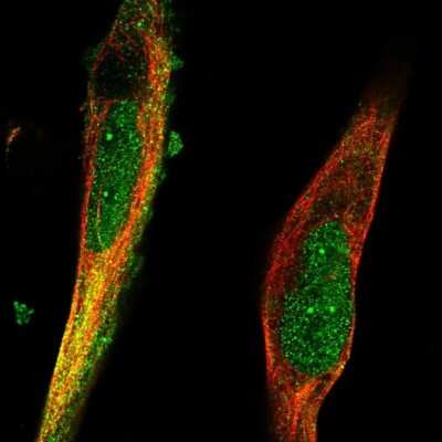 Immunocytochemistry/ Immunofluorescence: RNF98 Antibody [NBP2-56200]