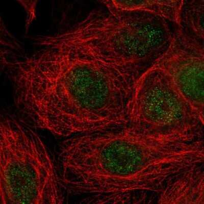 Immunocytochemistry/ Immunofluorescence: RNFT2 Antibody [NBP2-32383]