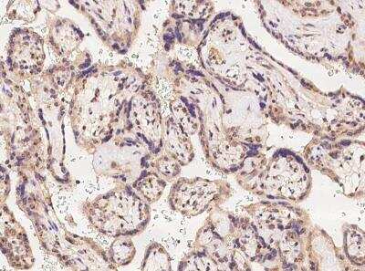 Immunohistochemistry-Paraffin: RNFT2 Antibody [NBP3-06145]