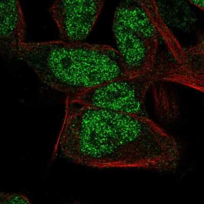 Immunocytochemistry/ Immunofluorescence: RNGTT Antibody [NBP1-83281]