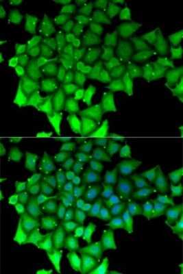 Immunocytochemistry/ Immunofluorescence: RNGTT Antibody - BSA Free [NBP2-94014]