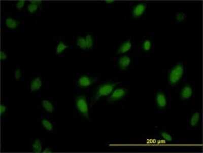 Immunocytochemistry/ Immunofluorescence: RNMT Antibody (3H3-1D12) [H00008731-M01]