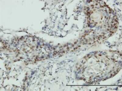 Immunohistochemistry-Paraffin: RNMT Antibody (3H3-1D12) [H00008731-M01]