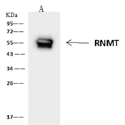 Immunoprecipitation: RNMT Antibody [NBP2-97644]