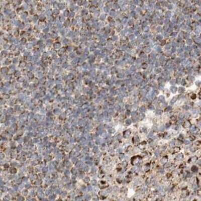 Immunohistochemistry-Paraffin: RNMTL1 Antibody [NBP1-83843]