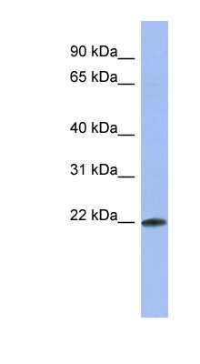 Western Blot: RNPC1 Antibody [NBP1-57503]