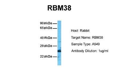 Western Blot: RNPC1 Antibody [NBP2-86780]