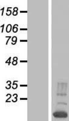 Western Blot: RNPC1 Overexpression Lysate [NBP2-04771]