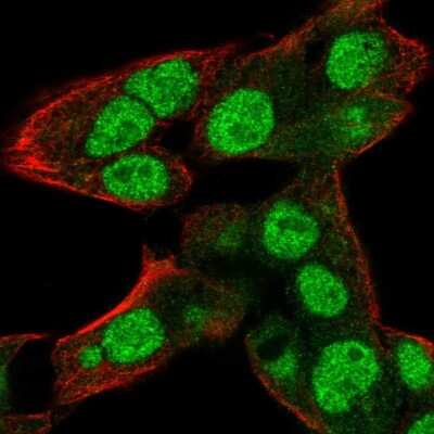 Immunocytochemistry/ Immunofluorescence: RNPEPL1 Antibody [NBP1-86282]