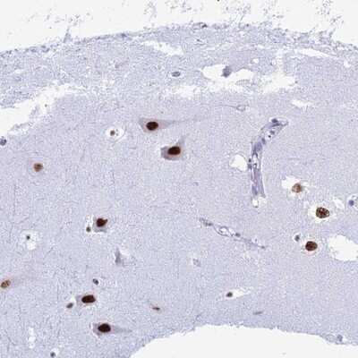 Immunohistochemistry-Paraffin: RNPS1 Antibody [NBP1-92343]