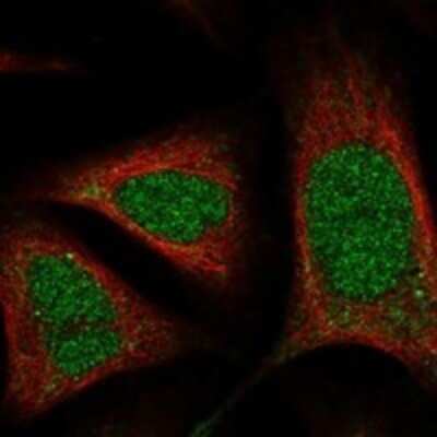 Immunocytochemistry/ Immunofluorescence: RNase H1 Antibody [NBP3-17926]