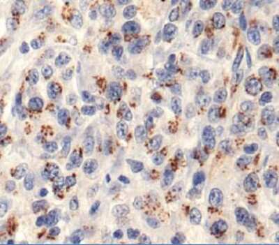 Immunohistochemistry: ROBLD3 Antibody [NBP1-71687]