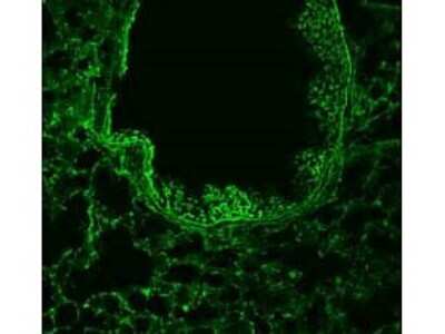 Immunohistochemistry: ROBO1 Antibody [NB600-1254]