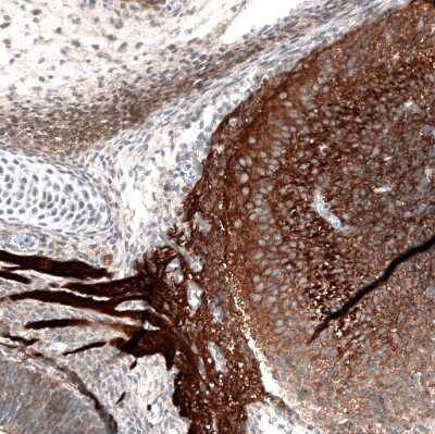 Immunohistochemistry-Paraffin: ROBO2 Antibody [NBP1-81399]