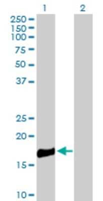 Western Blot: ROBO3 Antibody [H00064221-B01P]