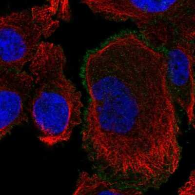 Immunocytochemistry/ Immunofluorescence: ROBO4 Antibody [NBP2-57071]