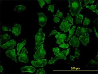 Immunocytochemistry/ Immunofluorescence: ROCK1 Antibody (2E2) [H00006093-M01]