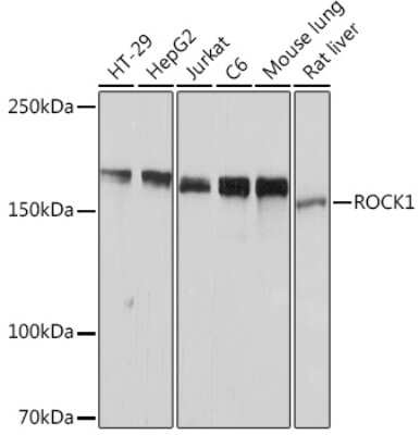 Western Blot: ROCK1 Antibody (H5E4) [NBP3-15350]