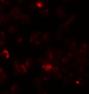 Immunocytochemistry/ Immunofluorescence: ROCK1 Antibody - BSA Free [NBP1-76569]
