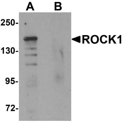 Western Blot: ROCK1 AntibodyBSA Free [NBP1-76569]