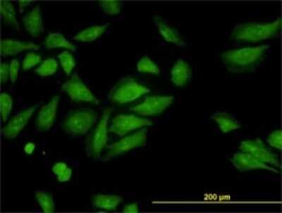 Immunocytochemistry/ Immunofluorescence: ROCK2 Antibody (2A4) [H00009475-M01]