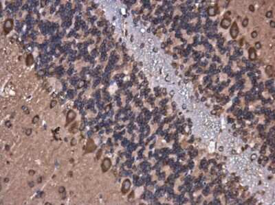 Immunohistochemistry-Paraffin: ROCK2 Antibody (GT11712) [NBP3-13535]