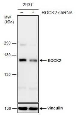 Western Blot: ROCK2 Antibody (GT11712) [NBP3-13535]