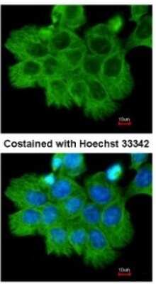 Immunocytochemistry/ Immunofluorescence: ROCK2 Antibody [NBP2-20199]