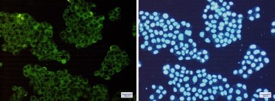 Immunocytochemistry/ Immunofluorescence: ROCK2 Antibody (S01-4F1) [NBP3-19508]