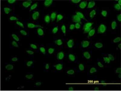 Immunocytochemistry/ Immunofluorescence: ROD1 Antibody (4C9) [H00009991-M01]