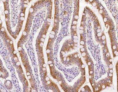 Immunohistochemistry-Paraffin: ROGDI Antibody [NBP3-12690]