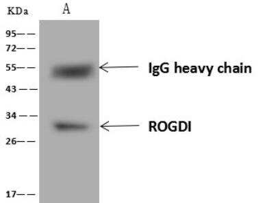Immunoprecipitation: ROGDI Antibody [NBP3-12690]
