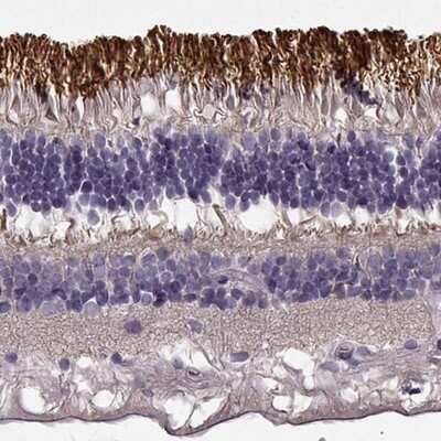 Immunohistochemistry-Paraffin: ROM1 Antibody [NBP2-58068]