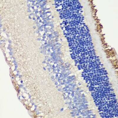 Immunohistochemistry-Paraffin: ROM1 Antibody - BSA Free [NBP3-04605]