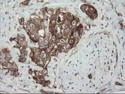 Immunohistochemistry: ROMO1 Antibody (OTI2C12) - Azide and BSA Free [NBP2-73928]