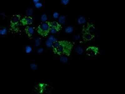 Immunocytochemistry/ Immunofluorescence: ROMO1 Antibody (OTI2C12) [NBP2-45607]