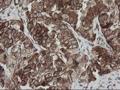 Immunohistochemistry: ROMO1 Antibody (OTI2C12) [NBP2-45607]