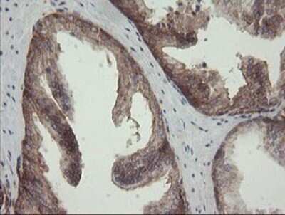 Immunohistochemistry: ROMO1 Antibody (OTI2C12) [NBP2-45607]