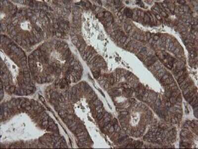 Immunohistochemistry: ROMO1 Antibody (OTI2C12) [NBP2-45607]